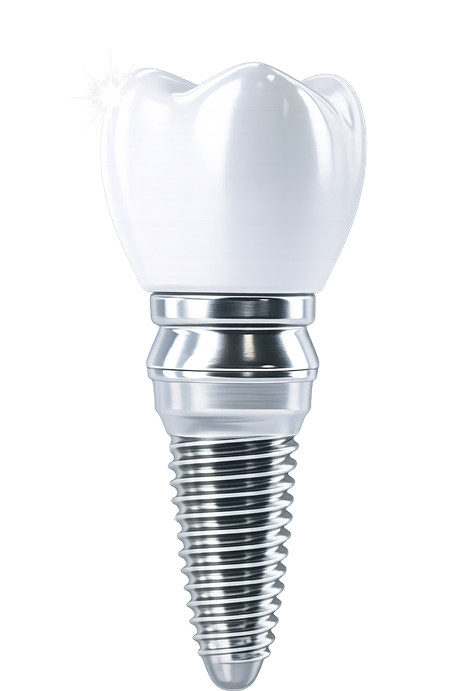 Dental Implant