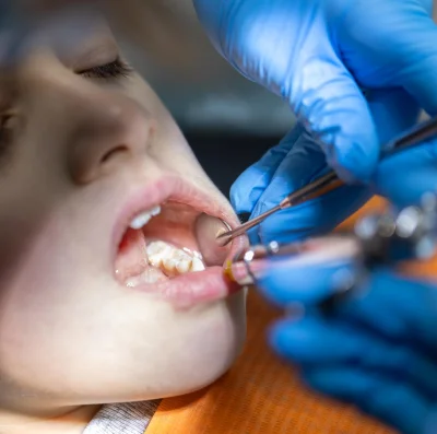 Paediatric Dentistry