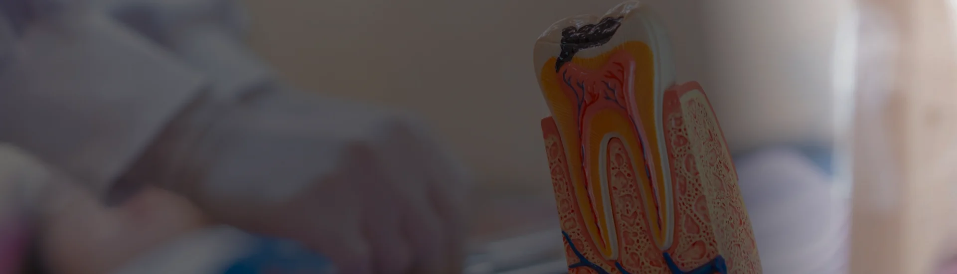 Root Canal Treatment