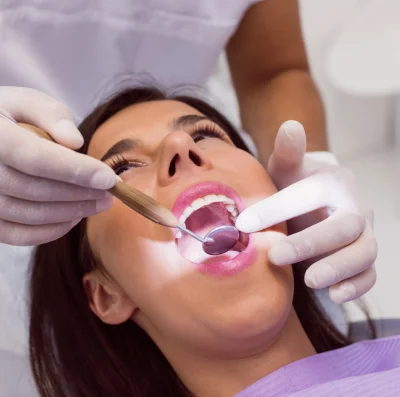 Teeth Cleaning