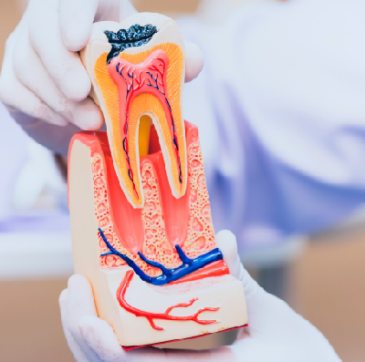 Root Canal Treatment