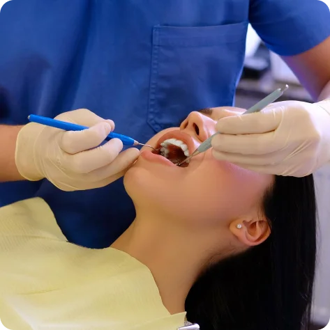 Teeth Whitening