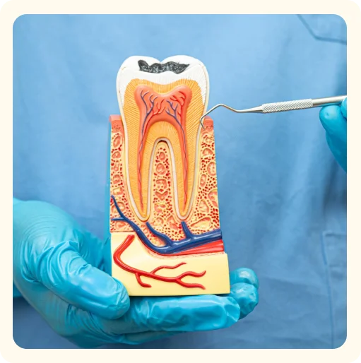 Root Canal Treatment