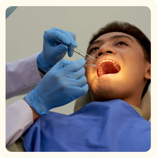 Tooth Extractions