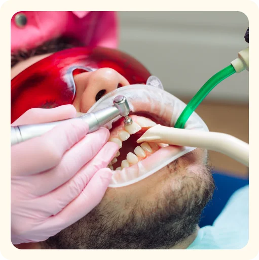 Teeth Cleaning