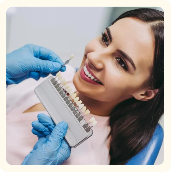 Veneers
